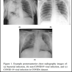 https://dailyalts.com/wp-content/uploads/2020/03/screenshot-arxiv.org-2020.03.26-10_51_11-AI-Radiography.png https://dailyalts.com/wp-content/uploads/2020/03/screenshot-arxiv.org-2020.03.26-10_51_11-AI-Radiography.png