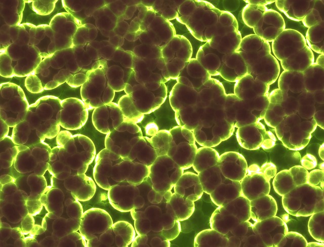 https://dailyalts.com/wp-content/uploads/2020/06/bacteria-1959386_640.jpg https://dailyalts.com/wp-content/uploads/2020/06/bacteria-1959386_640.jpg