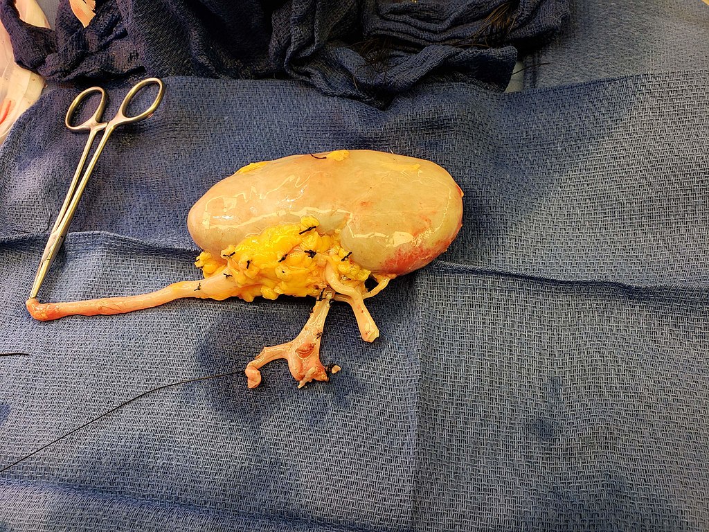 https://dailyalts.com/wp-content/uploads/2020/08/1024px-Kidney_for_transplant_from_live_donor.jpg
