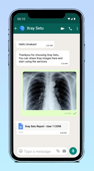 https://dailyalts.com/wp-content/uploads/2021/06/X-ray-setu-1.jpg https://dailyalts.com/wp-content/uploads/2021/06/X-ray-setu-1.jpg