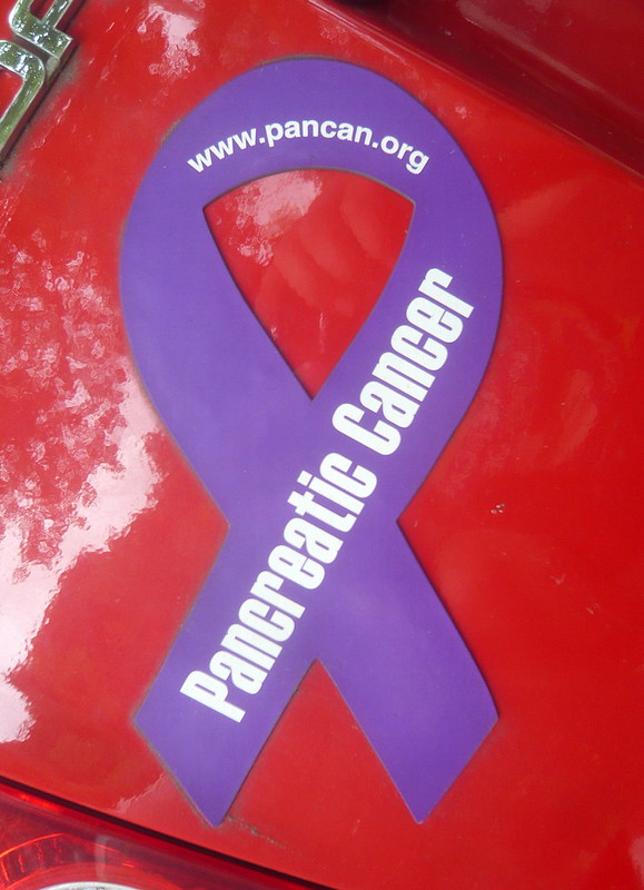 Predicts Risk Of Pancreatic Cancer Occurring In 36 Months - DailyAlts