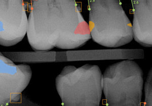findings1 findings1